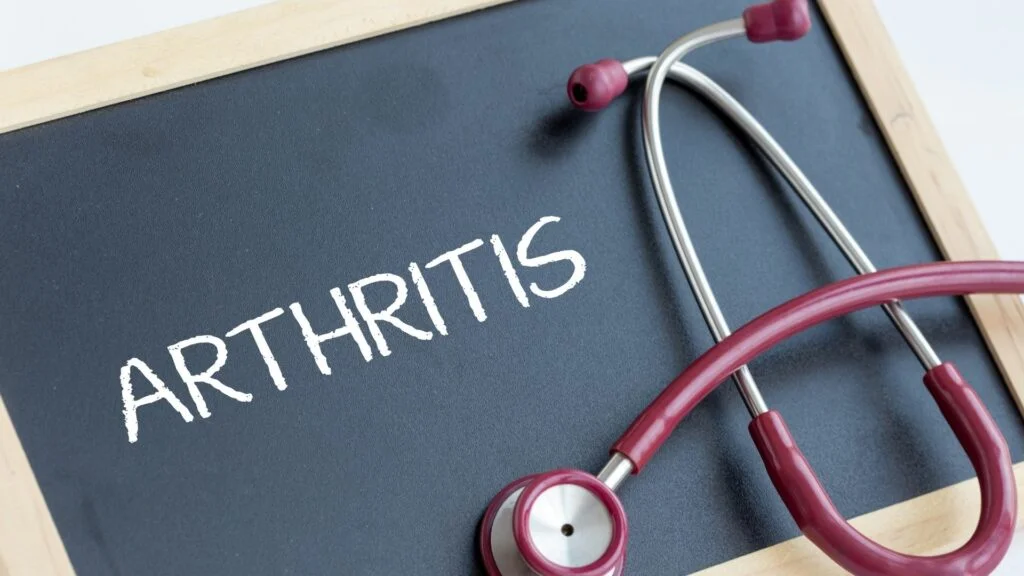 Arthritis: Types, Symptoms, Causes, Diagnosis and Treatment