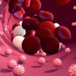 blood clot