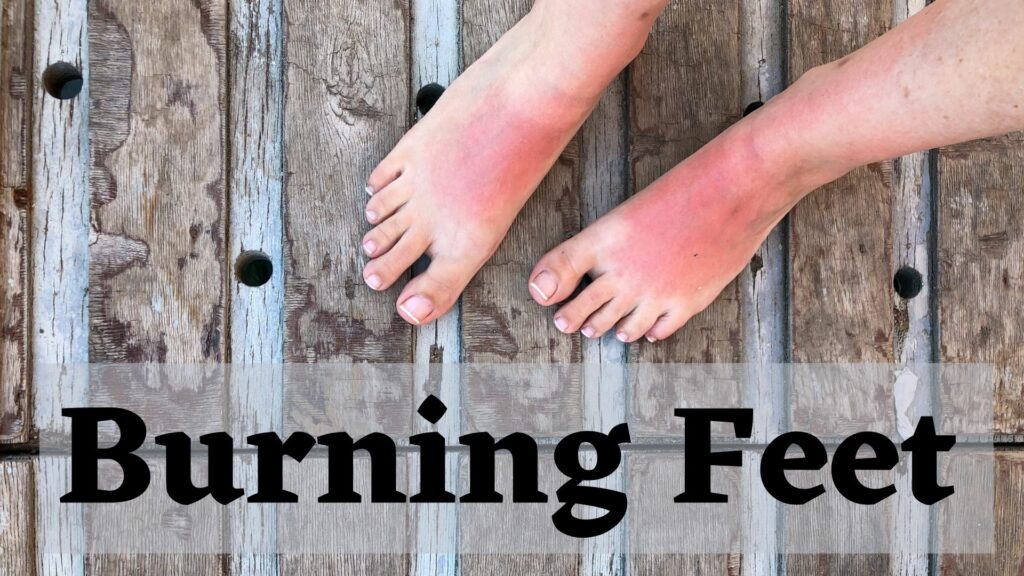 Burning feet