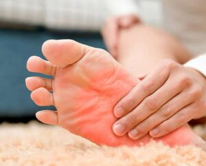 Causes of Burning Feet