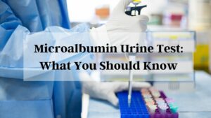 Microalbumin Urine: What You Should Know