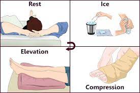Rest, ice, compression, and elevation (RICE)