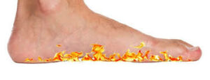 Symptoms of Burning Feet