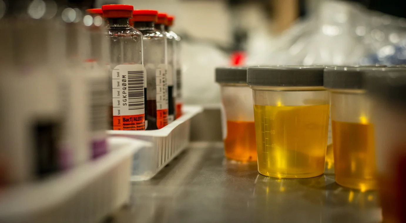 Drug tests