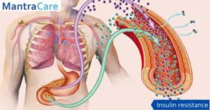 Insulin resistance