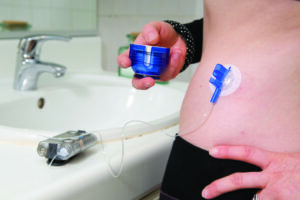 insulin pump