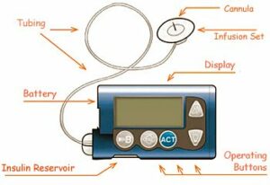 insulin pump parts