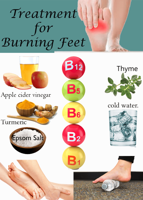 treatment of burning feet