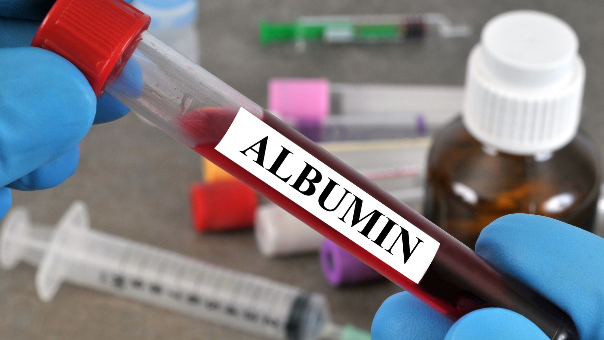 what is albumin