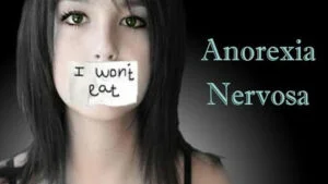 Anorexia Nervosa