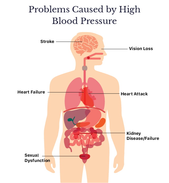 High BP Problems