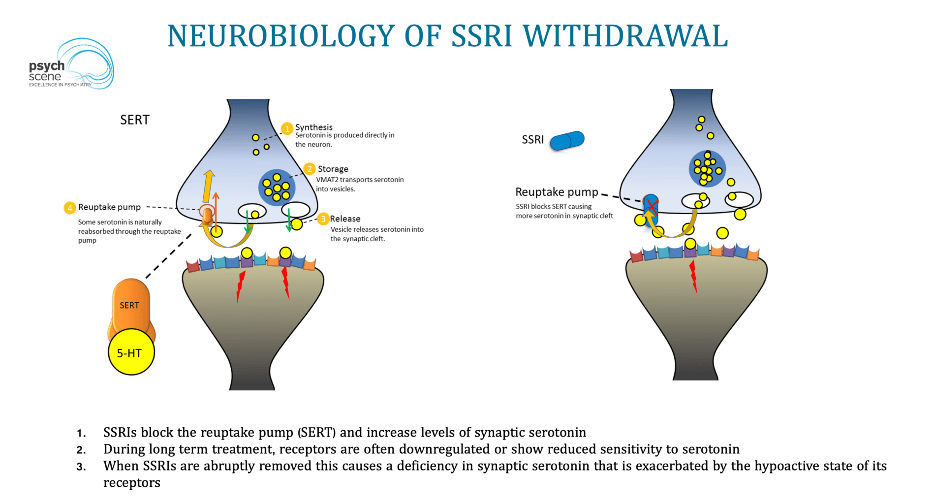 SSRI Withdrawal