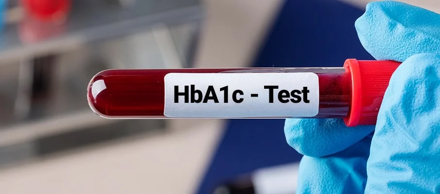 The A1c Test 