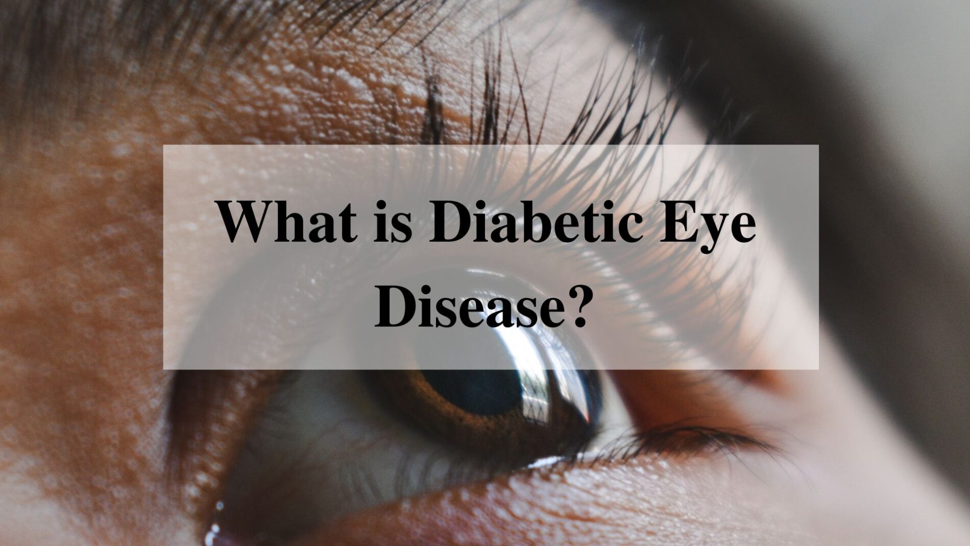 diabetic-eye-disease-symptoms-causes-treatment-and-more