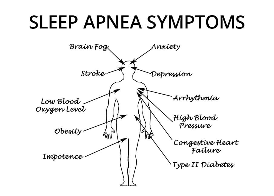 Sleep Apnea Types Symptoms Diagnosis Treatment And More 2995