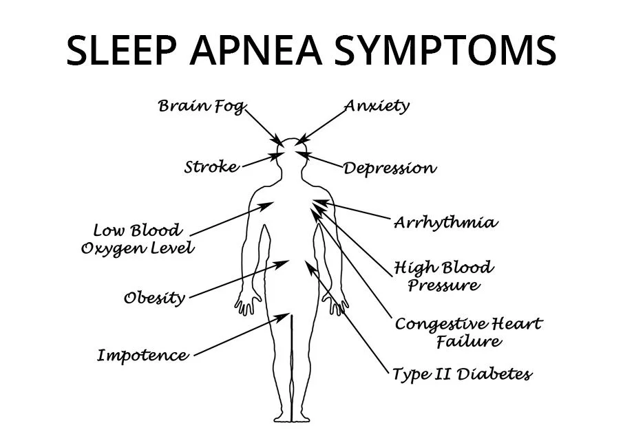 sleepapneasymptoms