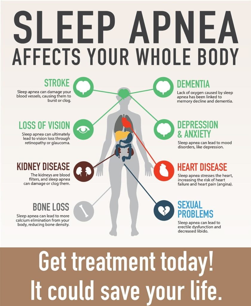 sleep apnea risks