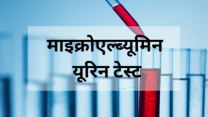 माइक्रो एल्ब्यूमिन यूरिन टेस्ट