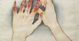 Dermatillomania