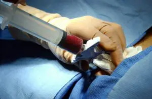 Stem Cell Transplants
