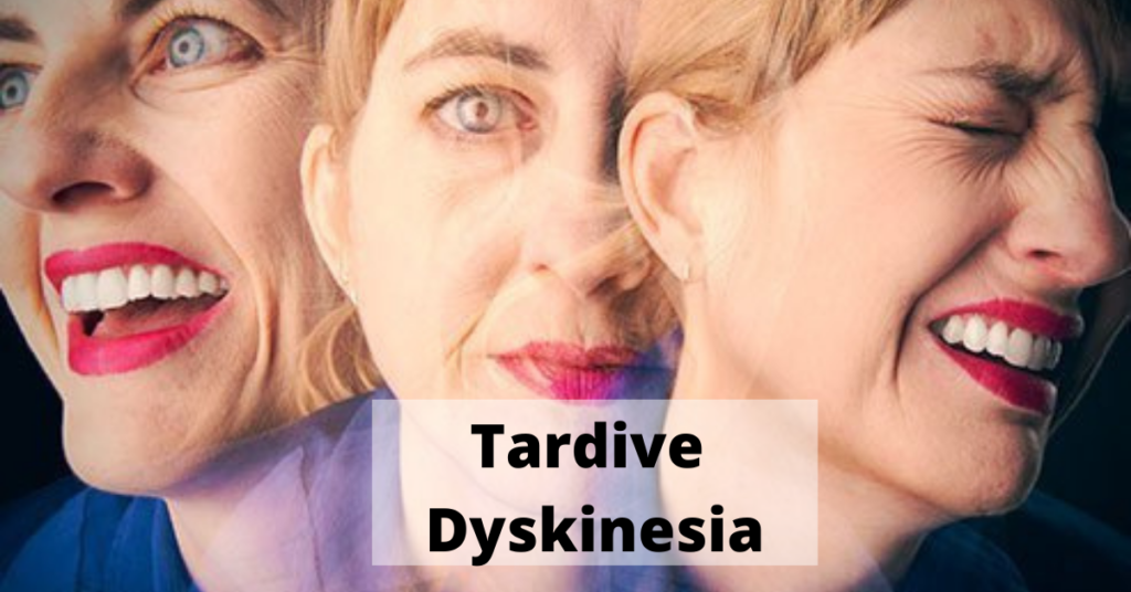 Tardive Dyskinesia: All About It
