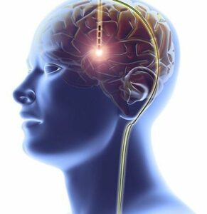 Transcranial Stimulation Therapy side effects 