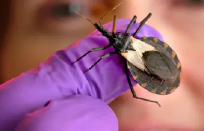 Treatment Options for Fear of Bugs