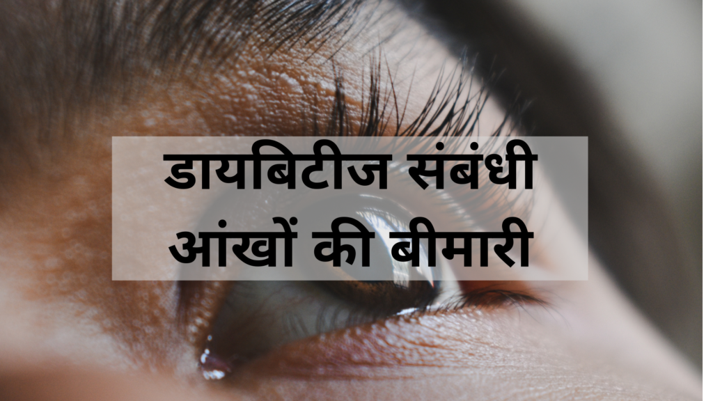 डायबिटीज संबंधी आंखों की बीमारी