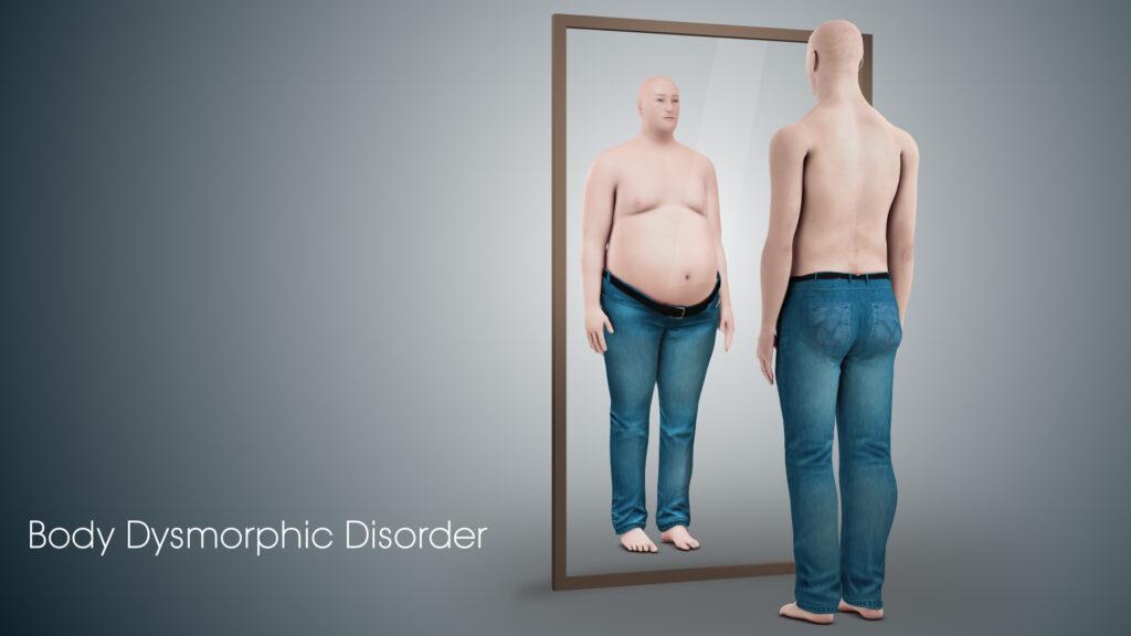 Body Dysmorphic Disorder : Signs, Causes, Treatment And More
