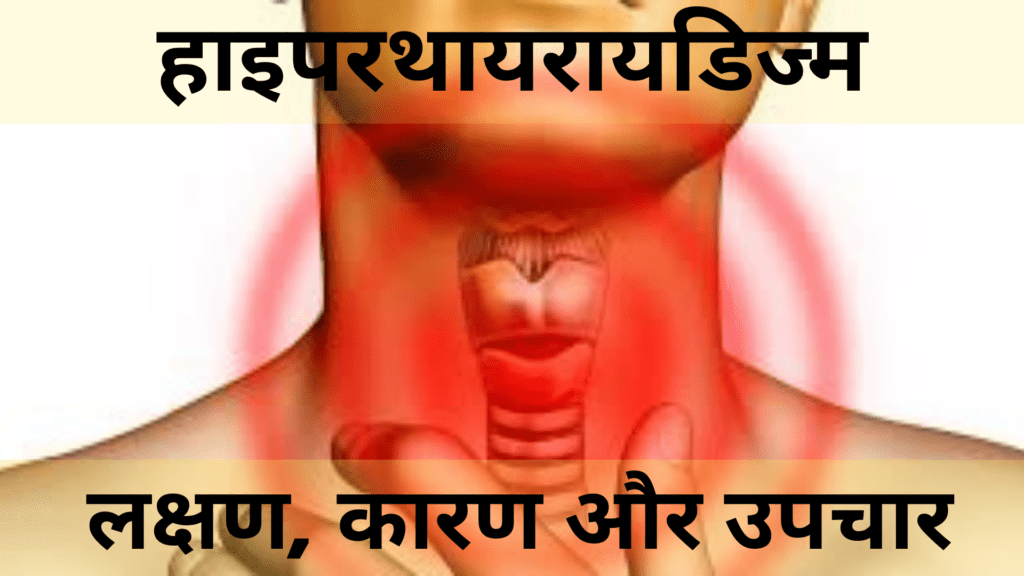 हाइपरथायरायडिज्म