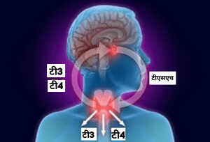 हाइपरथायरायडिज्म का निदान