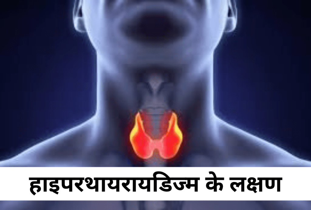 हाइपरथायरायडिज्म का निदान