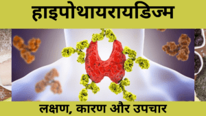 hypothyroidism