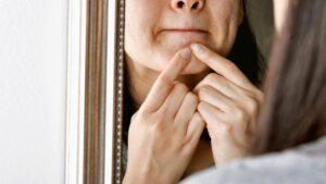 What Are The Types of Body Dysmorphic Disorder