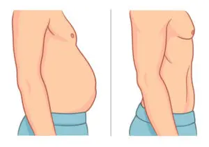 Abdominal Fat