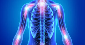 Reducing inflammation