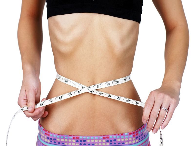 Severe Anorexia: What Is It, Signs, Causes And Treatment