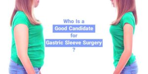 Who Is A Good Candidate For Gastric Sleeve Surgery