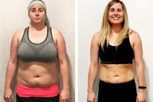 PCOS and Weight Gain: What You Need to Know