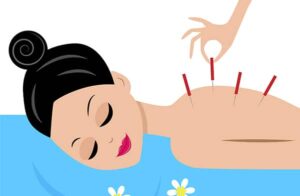 Acupuncture For Stress And Anxiety Article