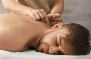 acupuncture session