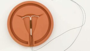 IUD And Weight Gain