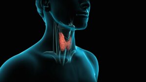 Surgery (Thyroidectomy)