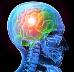 TBI And PTSD : Meaning And Relationship Between Them