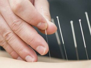 limitations of Acupuncture