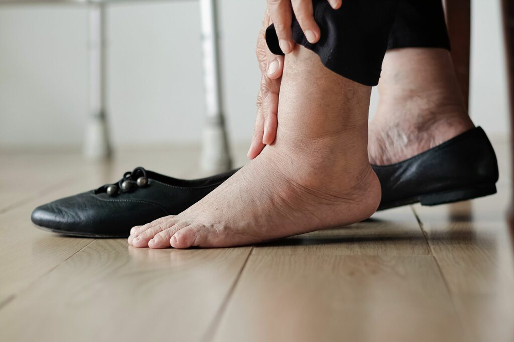 11 Causes of Fluid Retention and What to Do About It