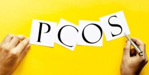Defining PCOS