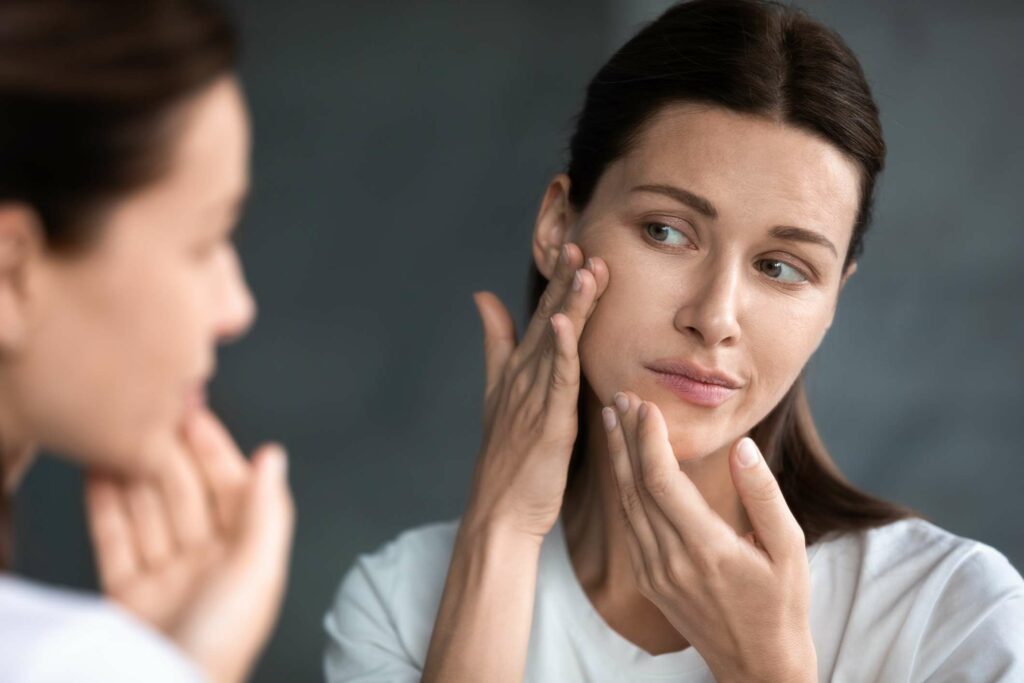 How to Treat PCOS Acne: Effective Solutions for Clearer Skin