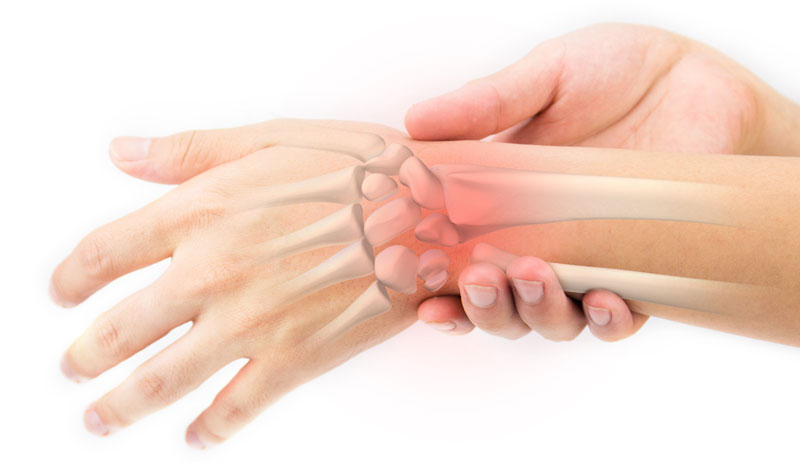 10 Possible Causes of Sharp Wrist Pain