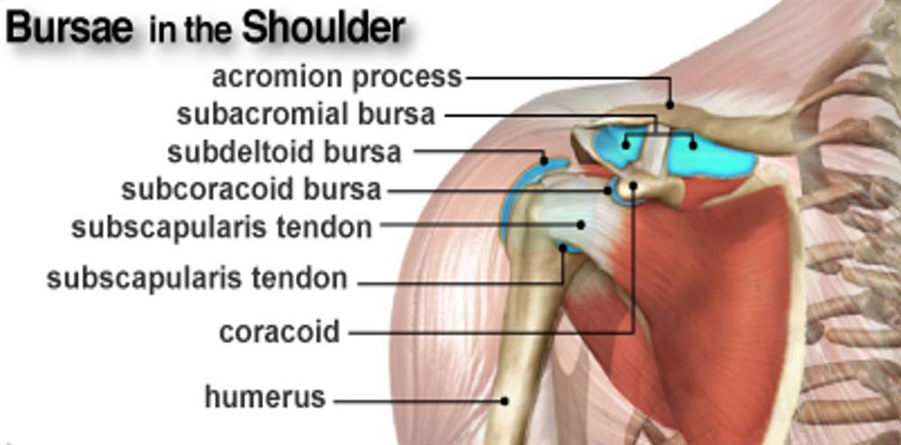 How to Recognize and Treat Bursitis in the Shoulder